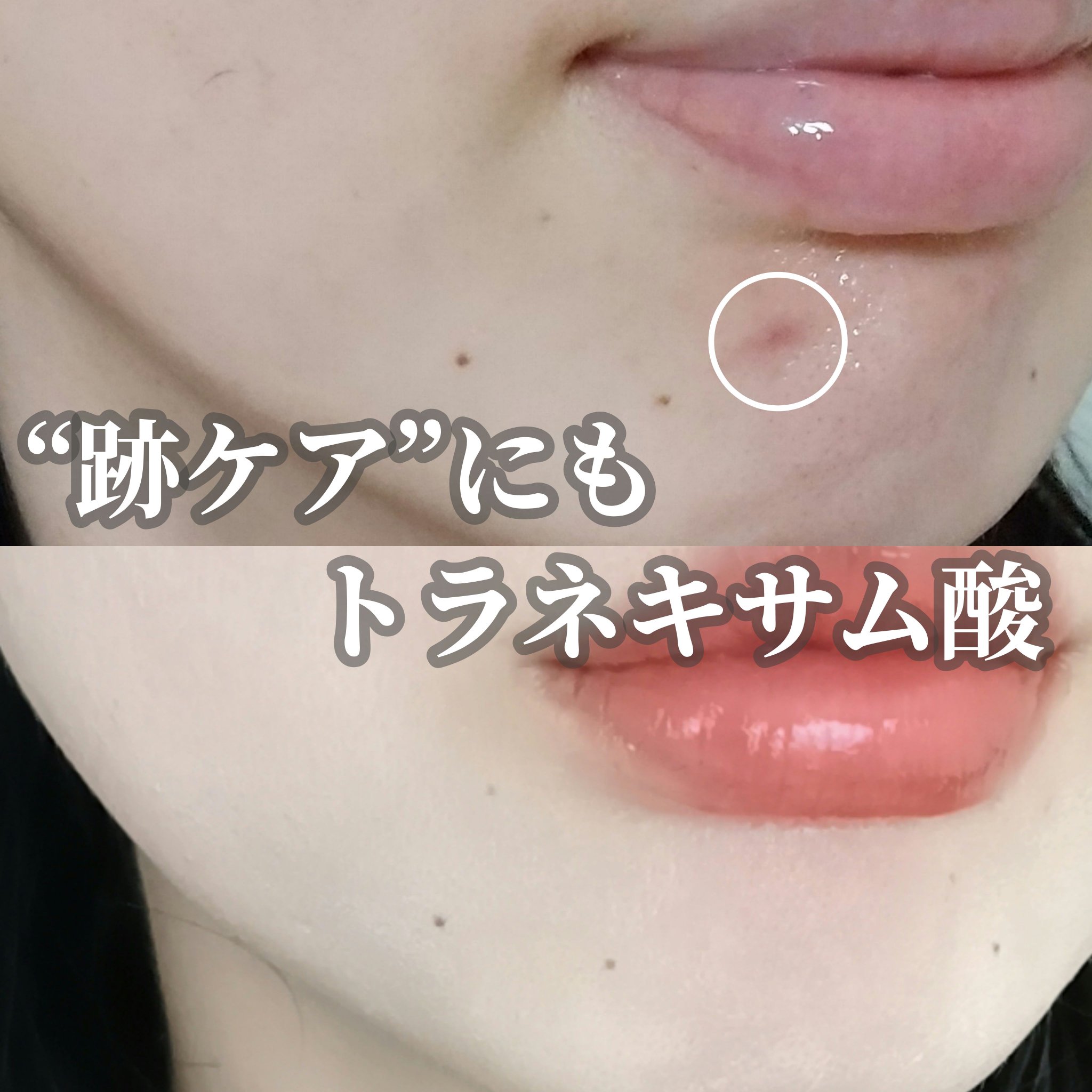 トラネキサム酸6％クリーム/DERMA FACTORY/フェイスクリームを使ったクチコミ（1枚目）