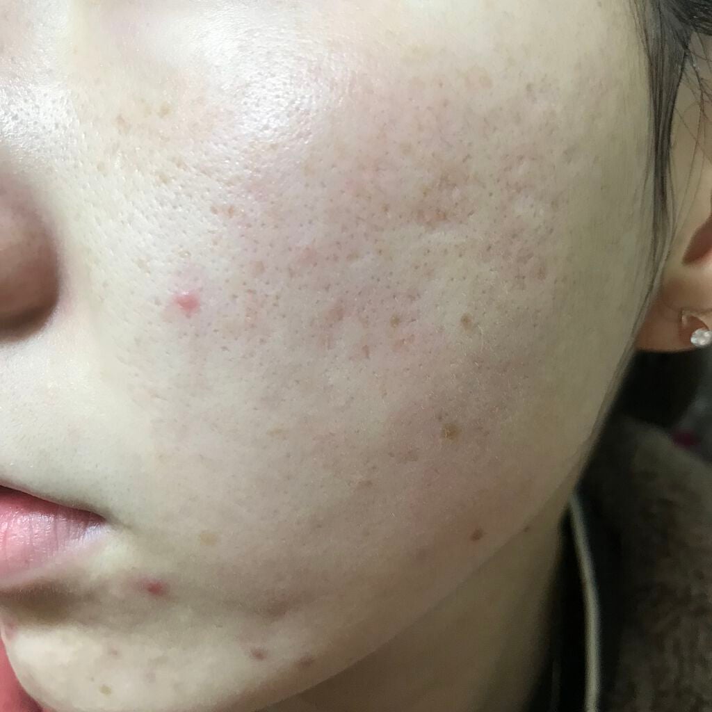 クリームバー ファンデーションN/ナチュラグラッセ/その他ファンデーションを使ったクチコミ(2枚目)