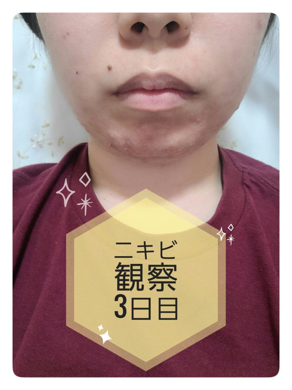 CICA スリーピングマスク/VT/シートマスク・パックを使ったクチコミ(1枚目)