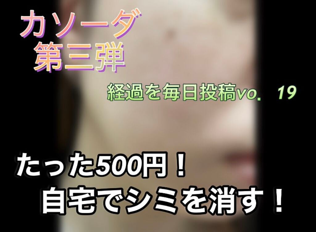 しい on LIPS 「カソーダ19日目昨日投稿し忘れた分です。皮むけがいっきに起こり..」(1枚目)