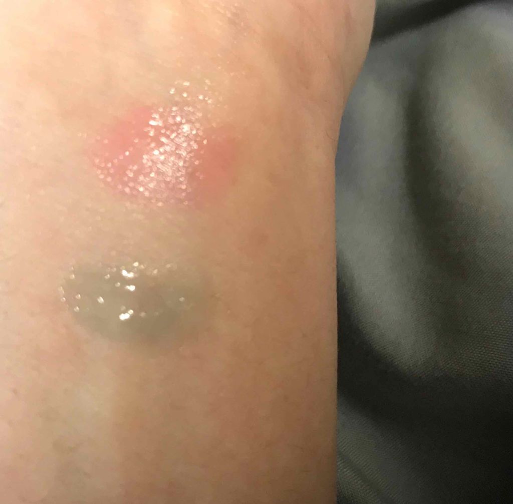 ユイルカレス/ロレアル パリ/リップグロスを使ったクチコミ（3枚目）