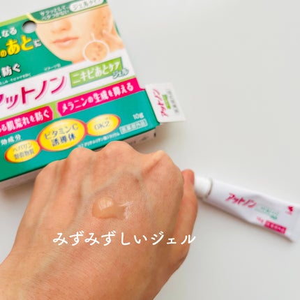 ニキビあとケアジェル/アットノン/その他スキンケアを使ったクチコミ(4枚目)