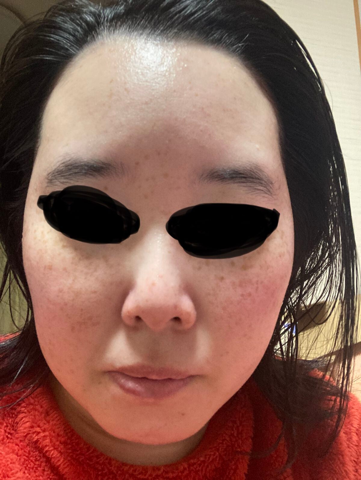 ルルルン ハイドラ V マスク/ルルルン/シートマスク・パックを使ったクチコミ(4枚目)