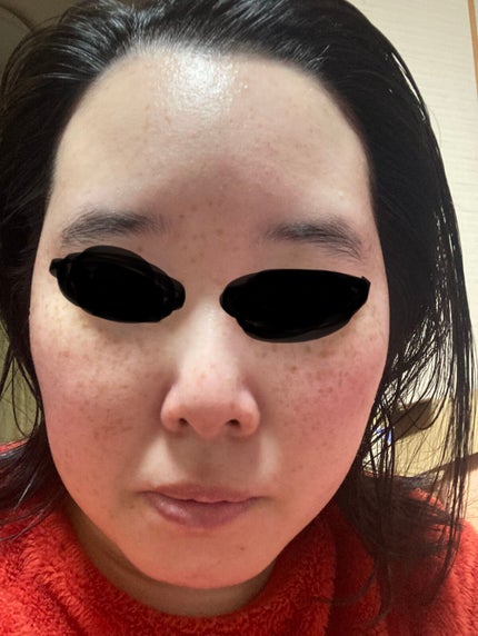 ルルルン ハイドラ V マスク/ルルルン/シートマスク・パックを使ったクチコミ(4枚目)