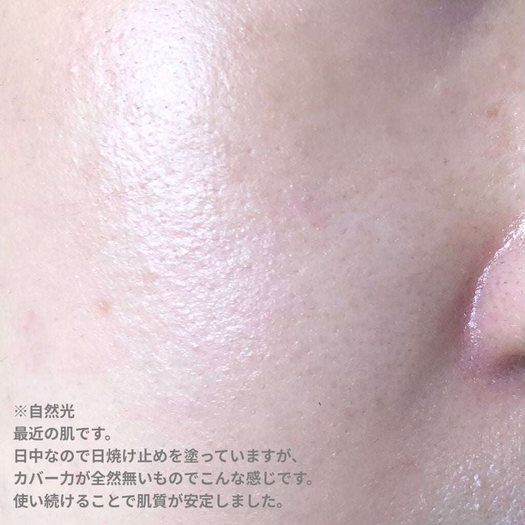 モイスチュア リポソーム/DECORTÉ/美容液を使ったクチコミ(3枚目)