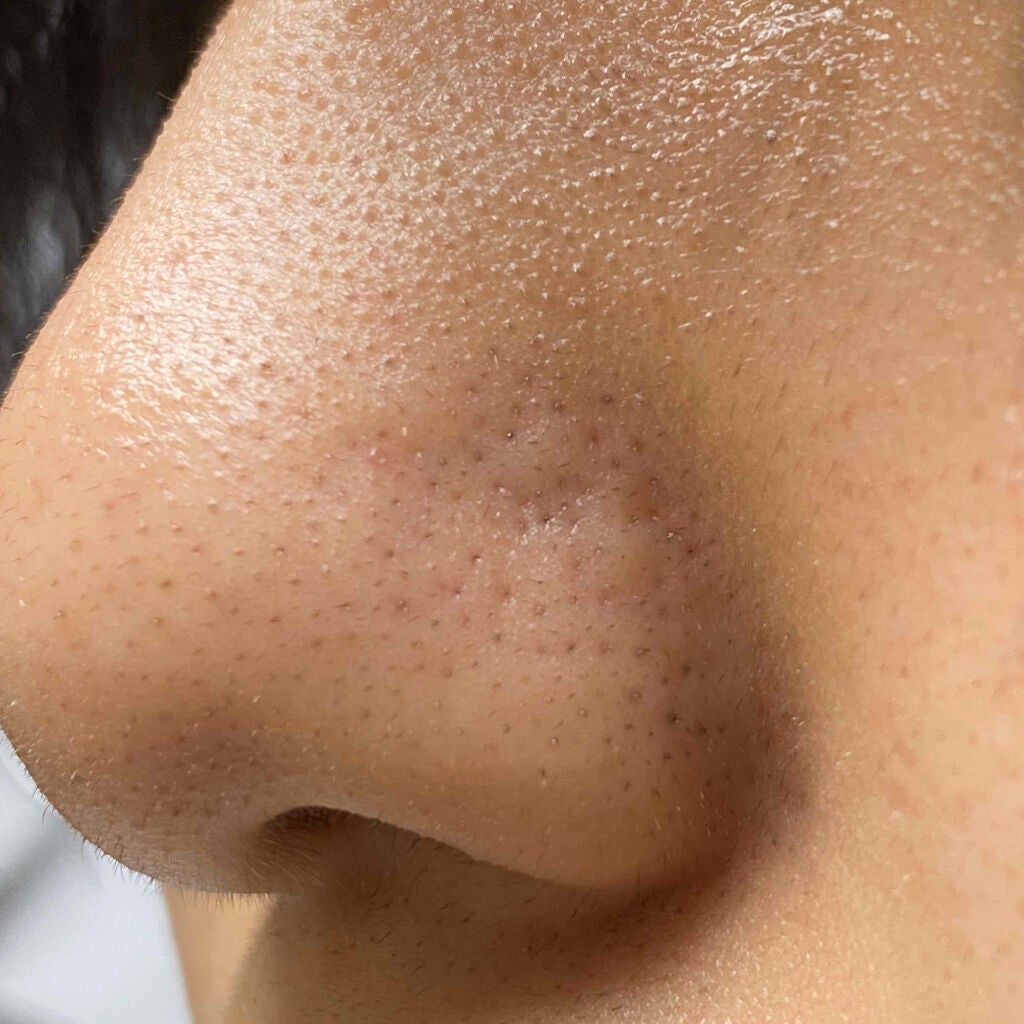 ハトムギ化粧水(ナチュリエ スキンコンディショナー R )/ナチュリエ/化粧水を使ったクチコミ(3枚目)