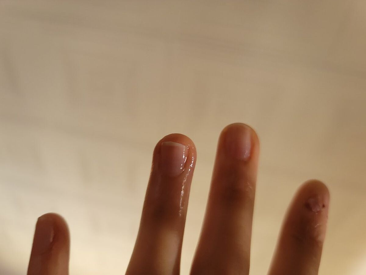 ポニキウムオイル/enieni /ネイルオイル・トリートメントを使ったクチコミ(3枚目)