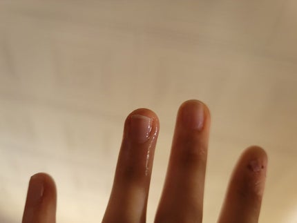 ポニキウムオイル/enieni /ネイルオイル・トリートメントを使ったクチコミ(3枚目)