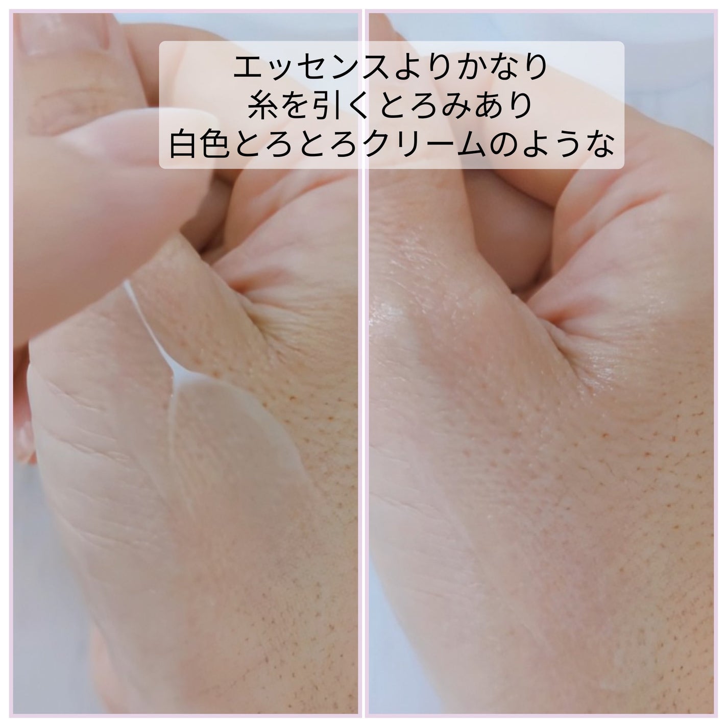 グルカミューンクリーム/VT/フェイスクリームを使ったクチコミ(6枚目)