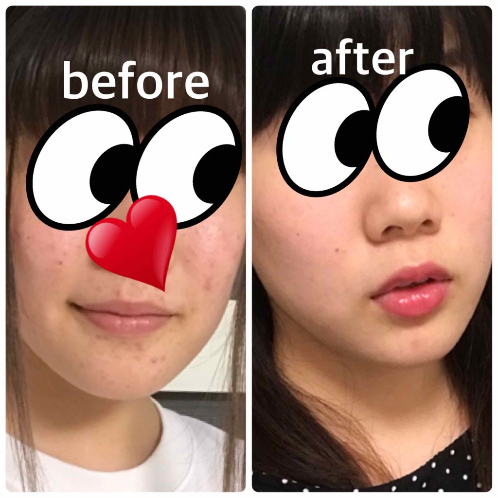 いつかの石けん/水橋保寿堂製薬/洗顔石鹸を使ったクチコミ（2枚目）