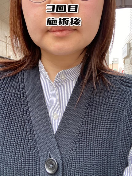 を使ったクチコミ(3枚目)