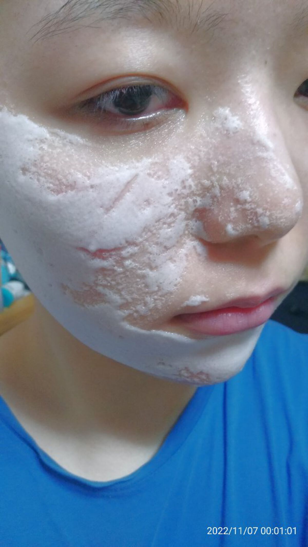 マジックバブルエッセンスパックMINI/BAKER7/シートマスク・パックを使ったクチコミ(6枚目)