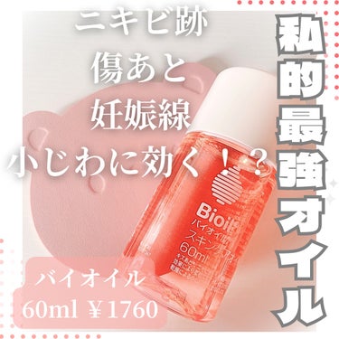 バイオイル バイオイルのクチコミ「＼市販で買える最強オイル！／
‎🤍バイオイル 60ml ￥1760‎🤍



妊娠線や傷あと、.....」（1枚目）