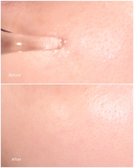 Cエッセンス VC5+PLUS /EBiS化粧品/美容液を使ったクチコミ(4枚目)