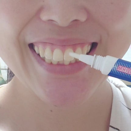 薬用ホワイトニング デンタブラッシュ EX/シーヴァ/その他オーラルケアを使ったクチコミ(3枚目)