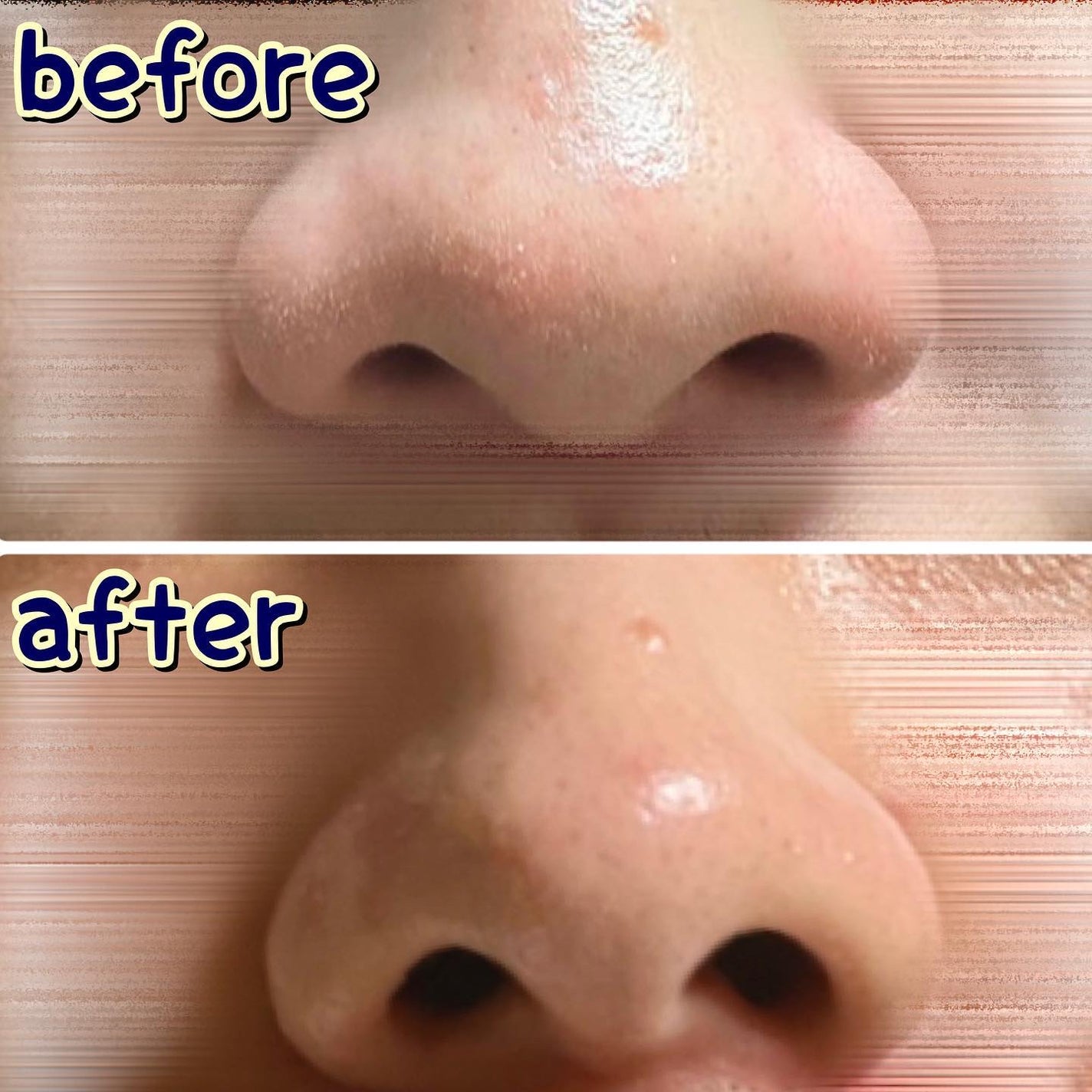 ノーモアブラックヘッド(ノーズピーリング)/One-day's you/スクラブ・ゴマージュを使ったクチコミ(5枚目)