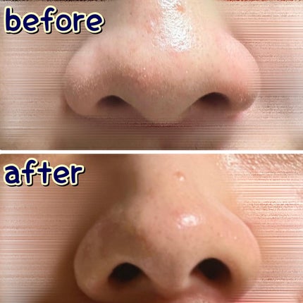 ノーモアブラックヘッド(ノーズピーリング)/One-day's you/スクラブ・ゴマージュを使ったクチコミ(5枚目)