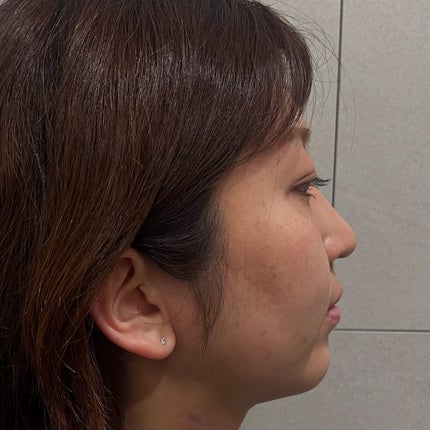 りーちゃん on LIPS 「気になるもたつき二重アゴを撃退したい!というこで、韓方ダイエッ..」(6枚目)