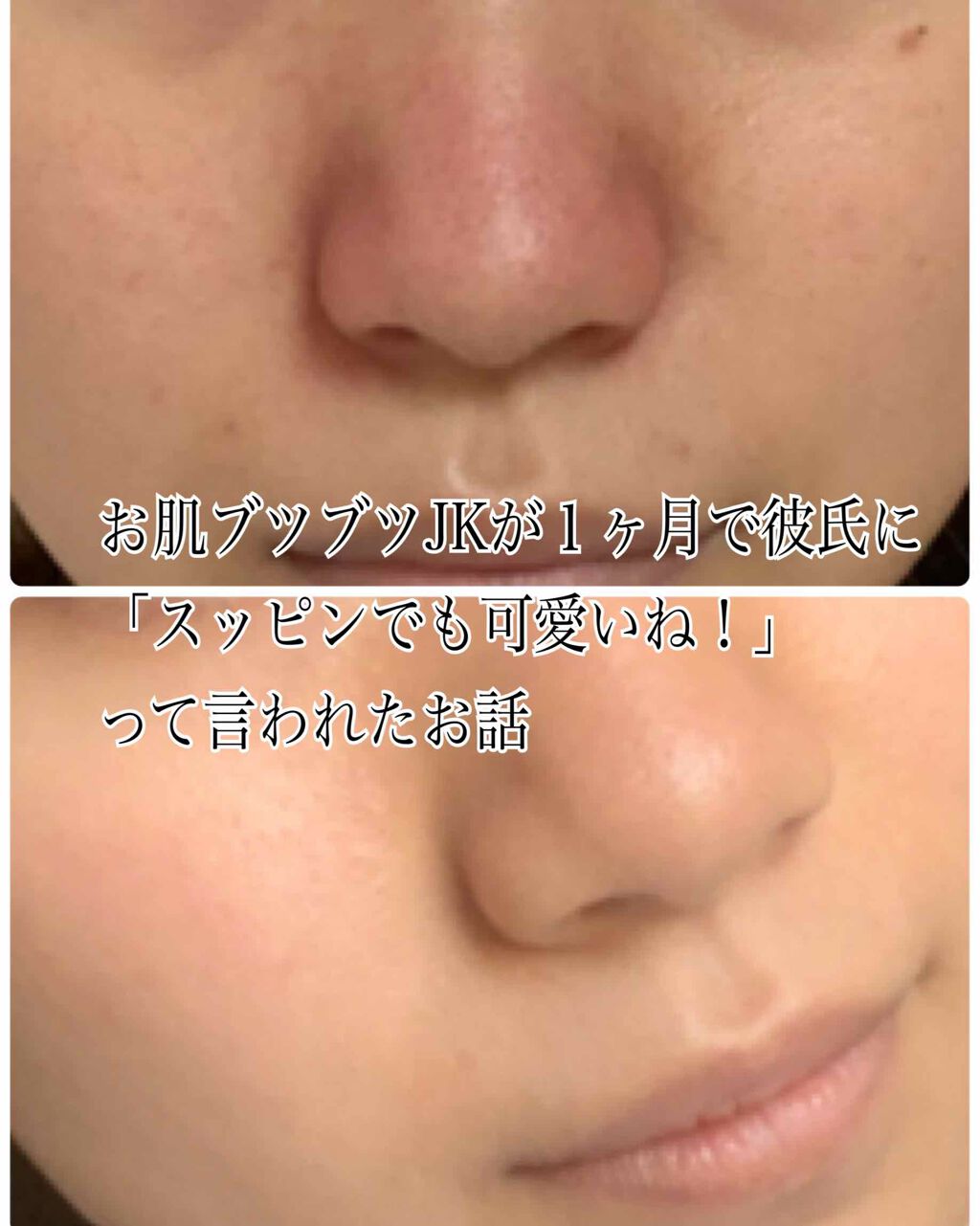 スキンケア方法 ロゼット洗顔パスタ ホワイトダイヤ ロゼットの使い方 効果 お肌ブツブツjkが１ヶ By やきにく 乾燥肌 10代後半 Lips