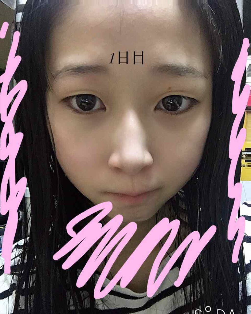  D濃密美容液 ヒアルロン酸/DAISO/美容液を使ったクチコミ（1枚目）