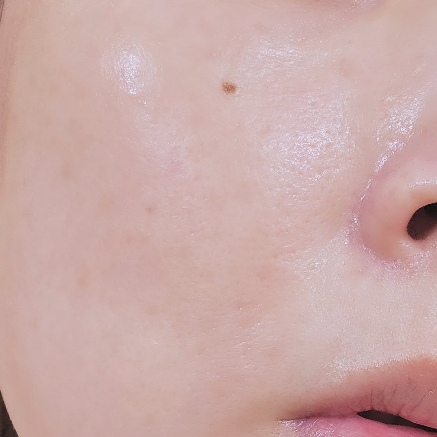 ダーマアンサー PDRN アクティブブースト1:1アンプル/CNP Laboratory/美容液を使ったクチコミ(6枚目)