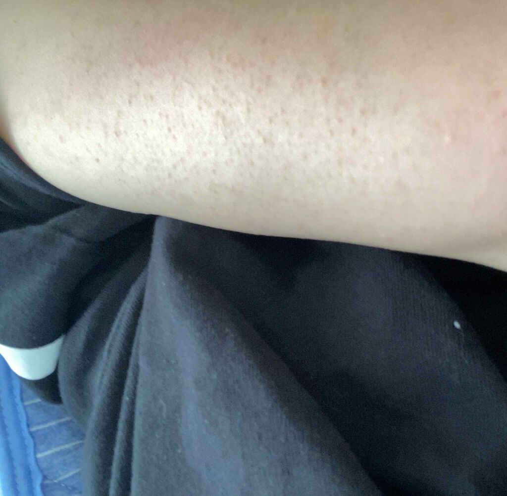 恋するおしり ヒップケアソープ/ペリカン石鹸/バスト・ヒップケアを使ったクチコミ(2枚目)