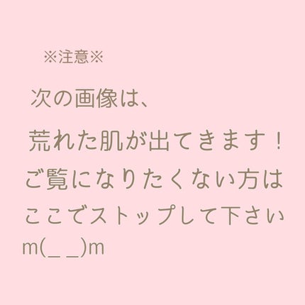 シカスリーピングマスク/LANEIGE/フェイスクリームを使ったクチコミ(7枚目)