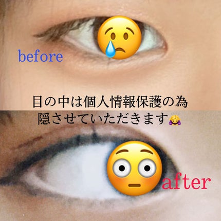 ルドゥーブル プレミアム/ルドゥーブル/二重まぶた用アイテムを使ったクチコミ(3枚目)