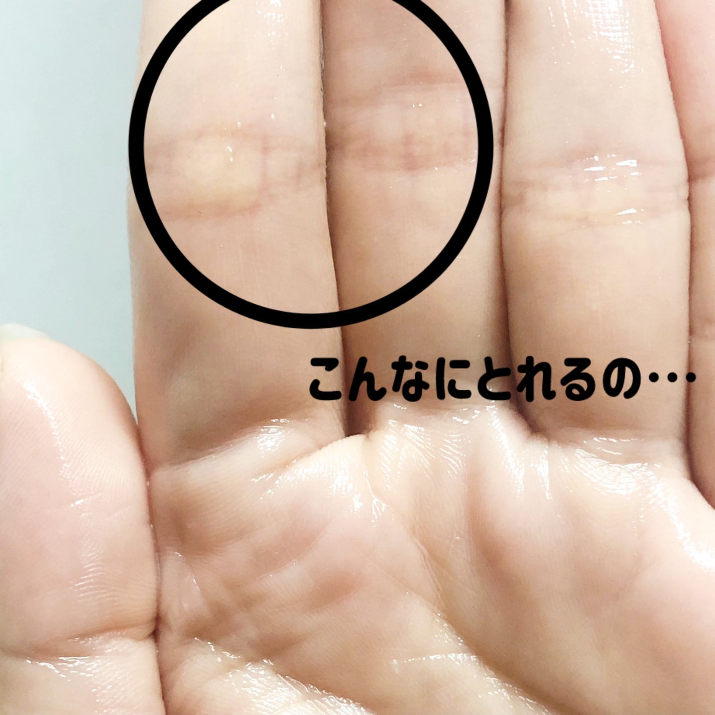 ブラックマグマ ホットクレンジングジェル/ロゼット/クレンジングジェルを使ったクチコミ(3枚目)