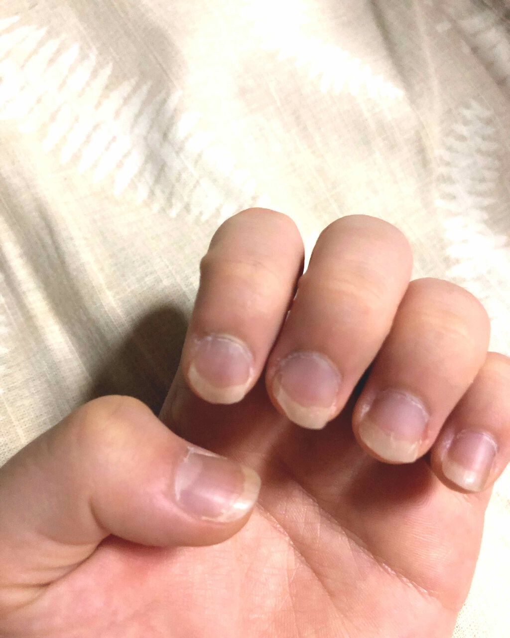 ゆ〜ん on LIPS 「お久しぶりです!今日はちょっと緊急事態というか助けてほしいです..」(2枚目)