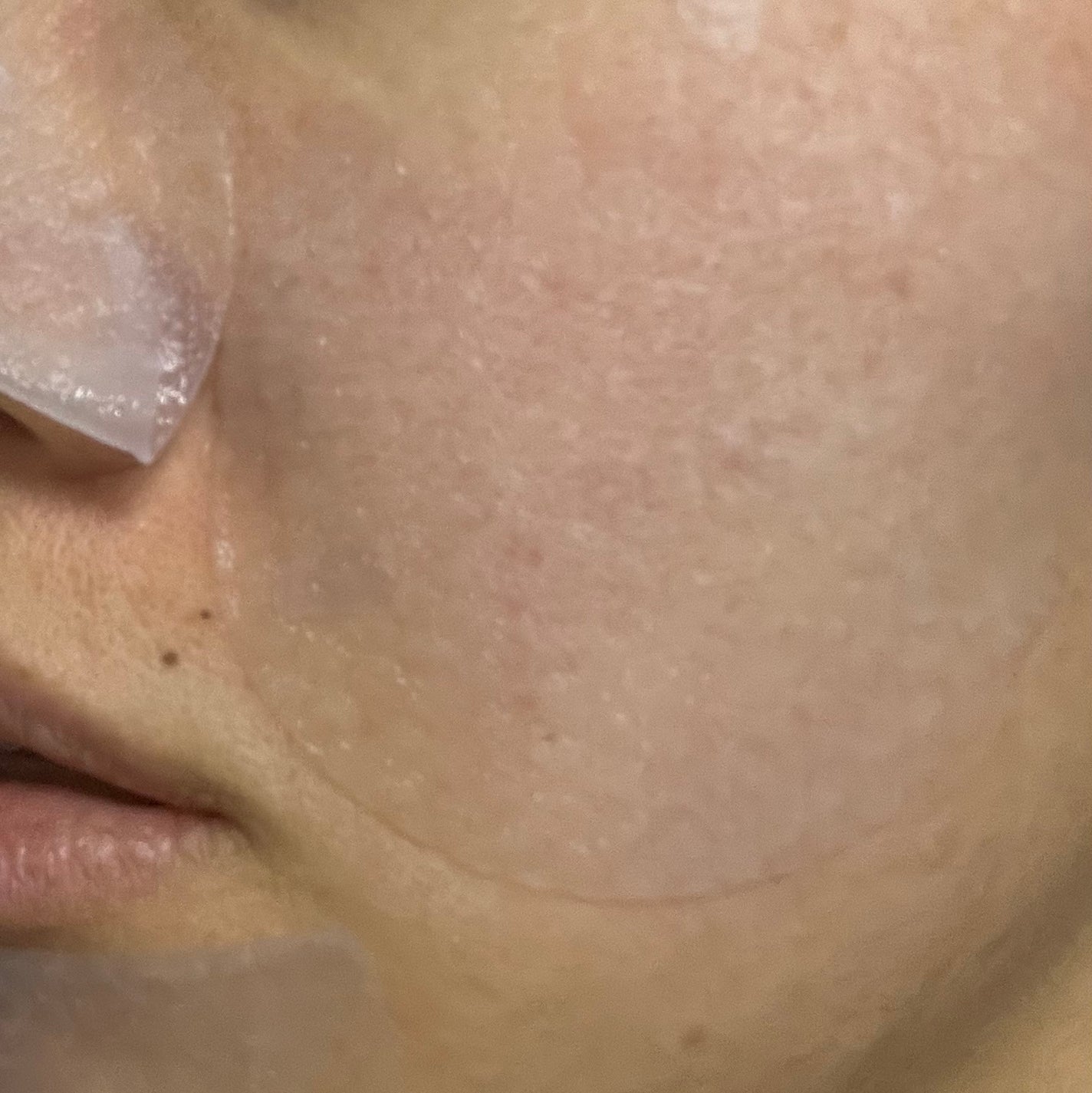 セラノールゲルトナーパッド/Biodance/トナーパッドを使ったクチコミ(2枚目)