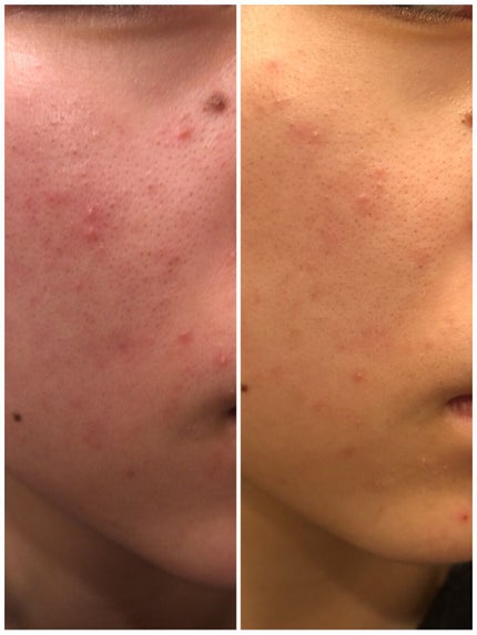 を使ったクチコミ(3枚目)