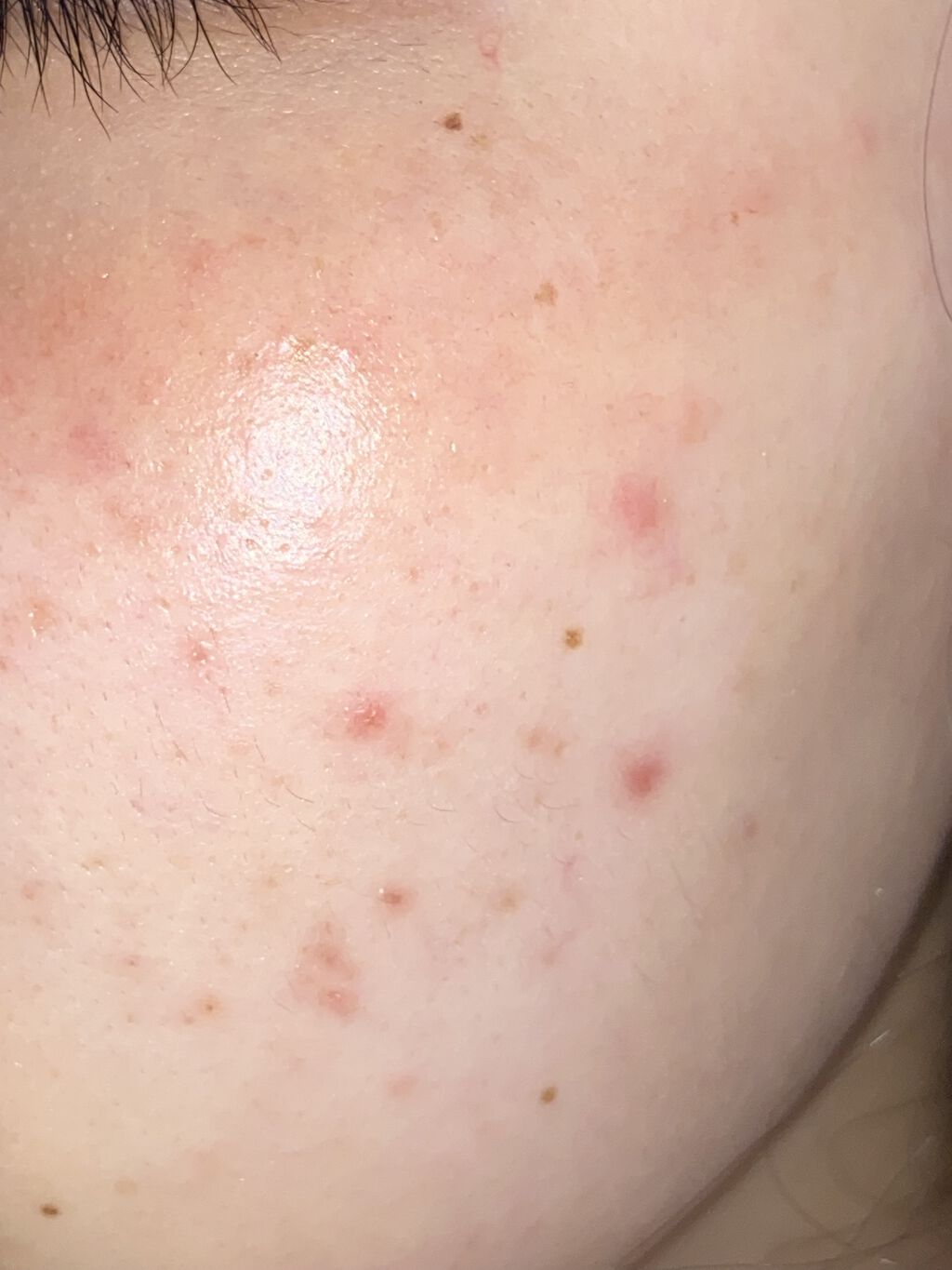 薬用スキンミルク/オードムーゲ/乳液を使ったクチコミ（3枚目）