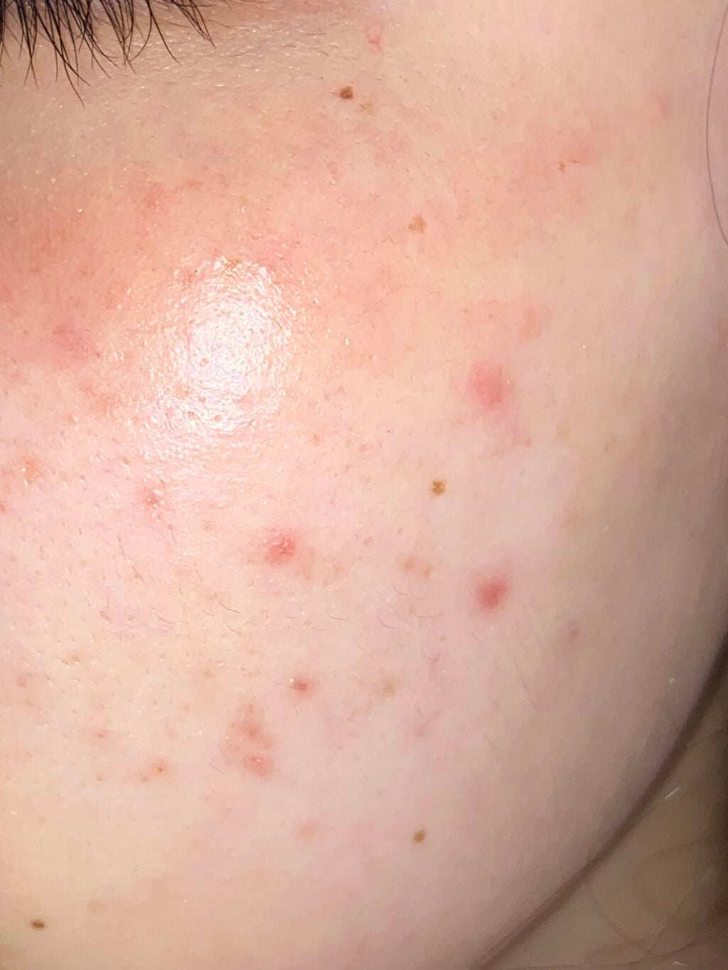 ハトムギ保湿ジェル(ナチュリエ スキンコンディショニングジェル)/ナチュリエ/美容液を使ったクチコミ(3枚目)