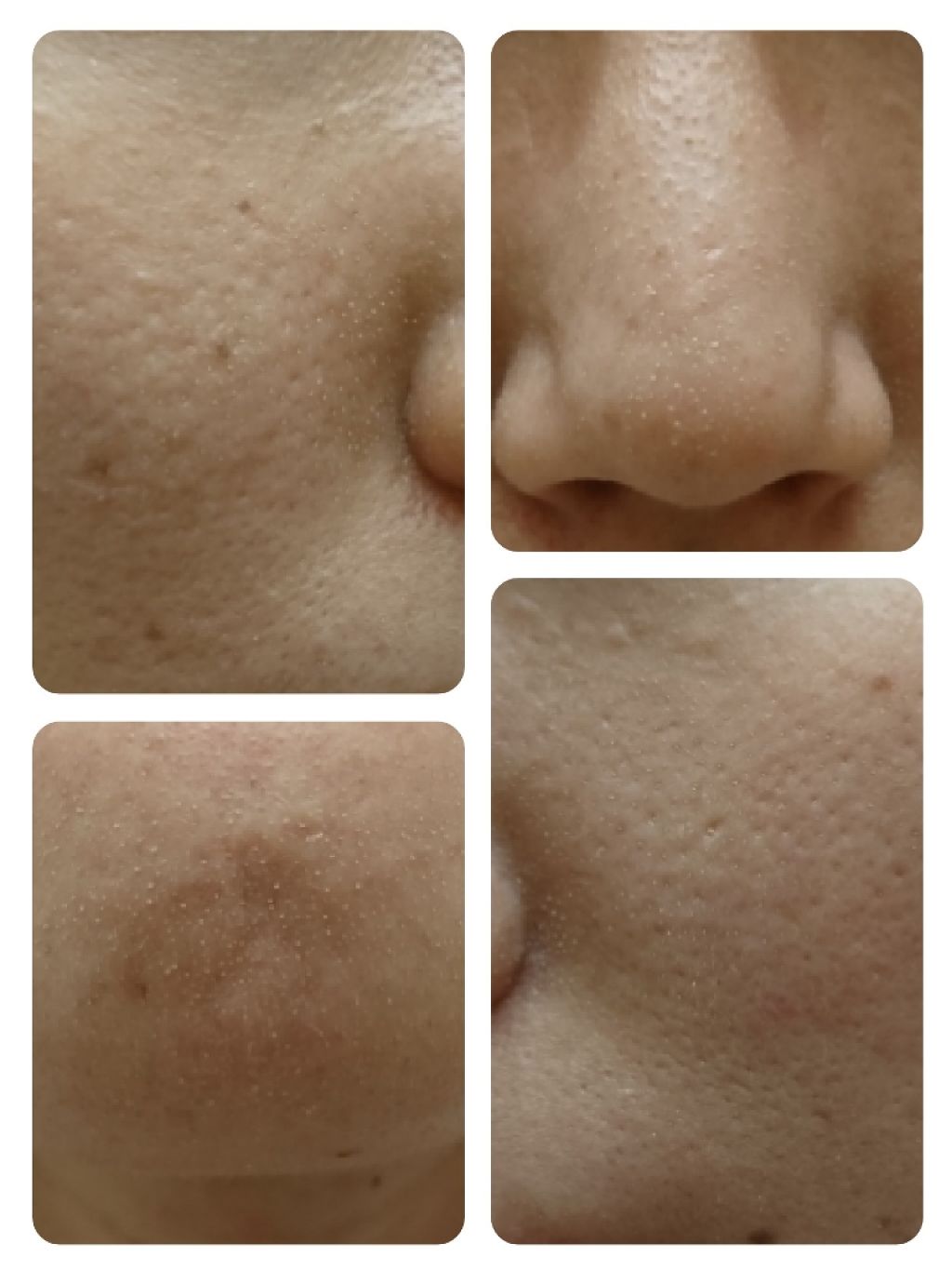 オールキル ブラックヘッド リムーバー スティック/RiRe/スクラブ・ゴマージュを使ったクチコミ（2枚目）