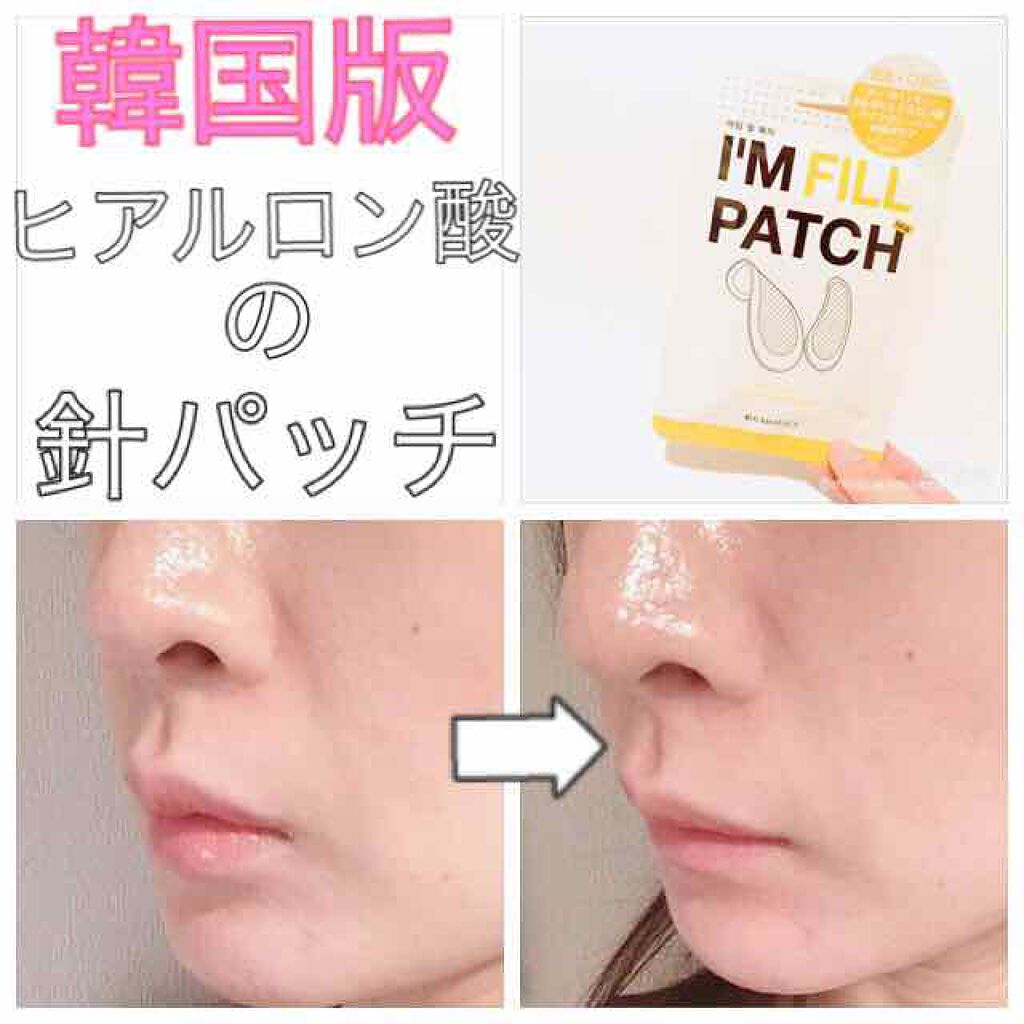 I'M FILL PATCH(アイムフィルパッチ)/I'Mシリーズ/シートマスク・パックを使ったクチコミ(1枚目)