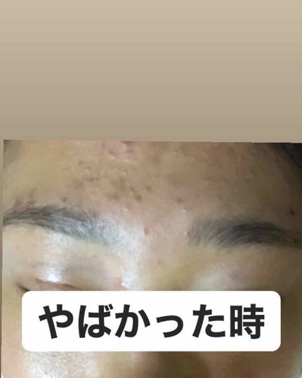 を使ったクチコミ(2枚目)