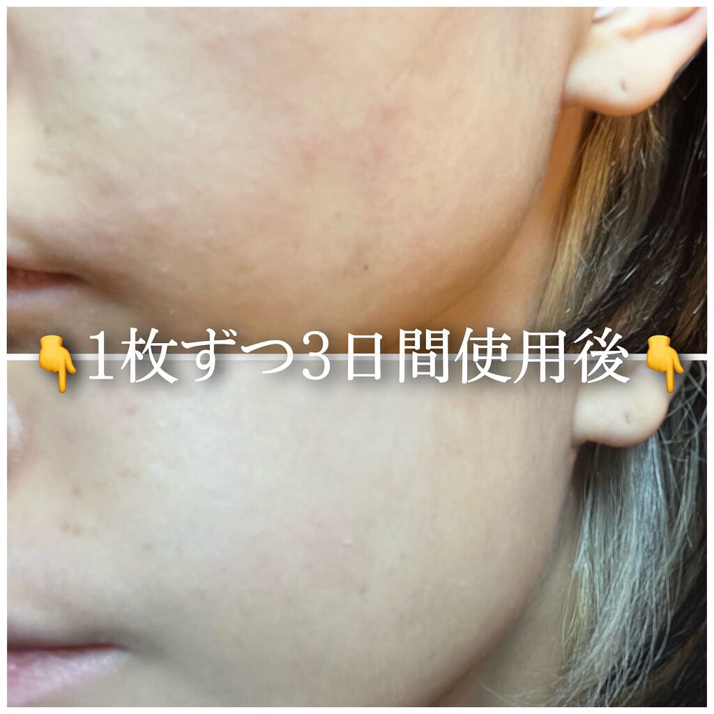 ミノン アミノモイスト ぷるぷるしっとり肌マスク/ミノン/シートマスク・パックを使ったクチコミ(5枚目)