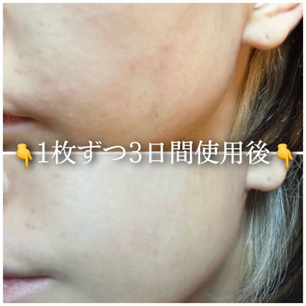 ミノン アミノモイスト ぷるぷるしっとり肌マスク/ミノン/シートマスク・パックを使ったクチコミ(5枚目)