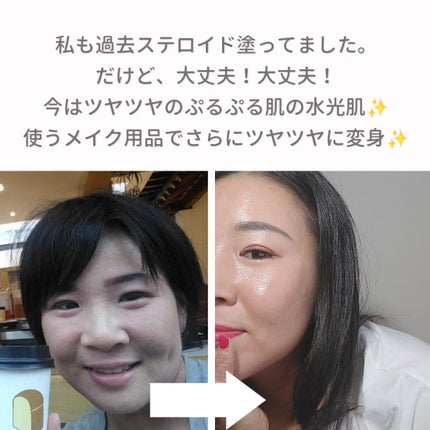 美肌カウンセラー💆肌悩みを解決し見る世界を変える on LIPS 「アトピーを乗りこえた先にある"誰もが手に入れたい陶器肌"それを..」(7枚目)