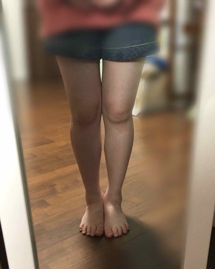 寝ながらメディキュット スパッツ 骨盤テーピング/メディキュット/着圧ソックス・レギンスを使ったクチコミ(1枚目)