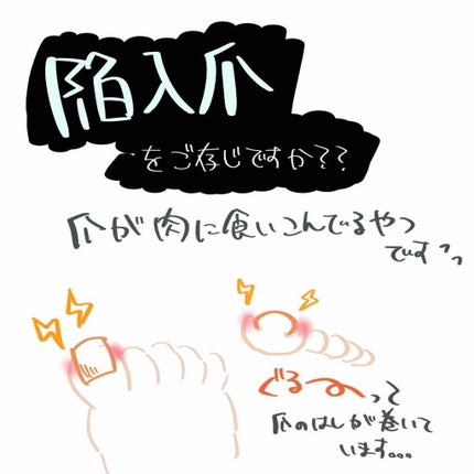 キラキラできない系女子 on LIPS 「【誰かの役に立てばいいなシリーズ】【脚の爪周りが痛くなる人に向..」(1枚目)
