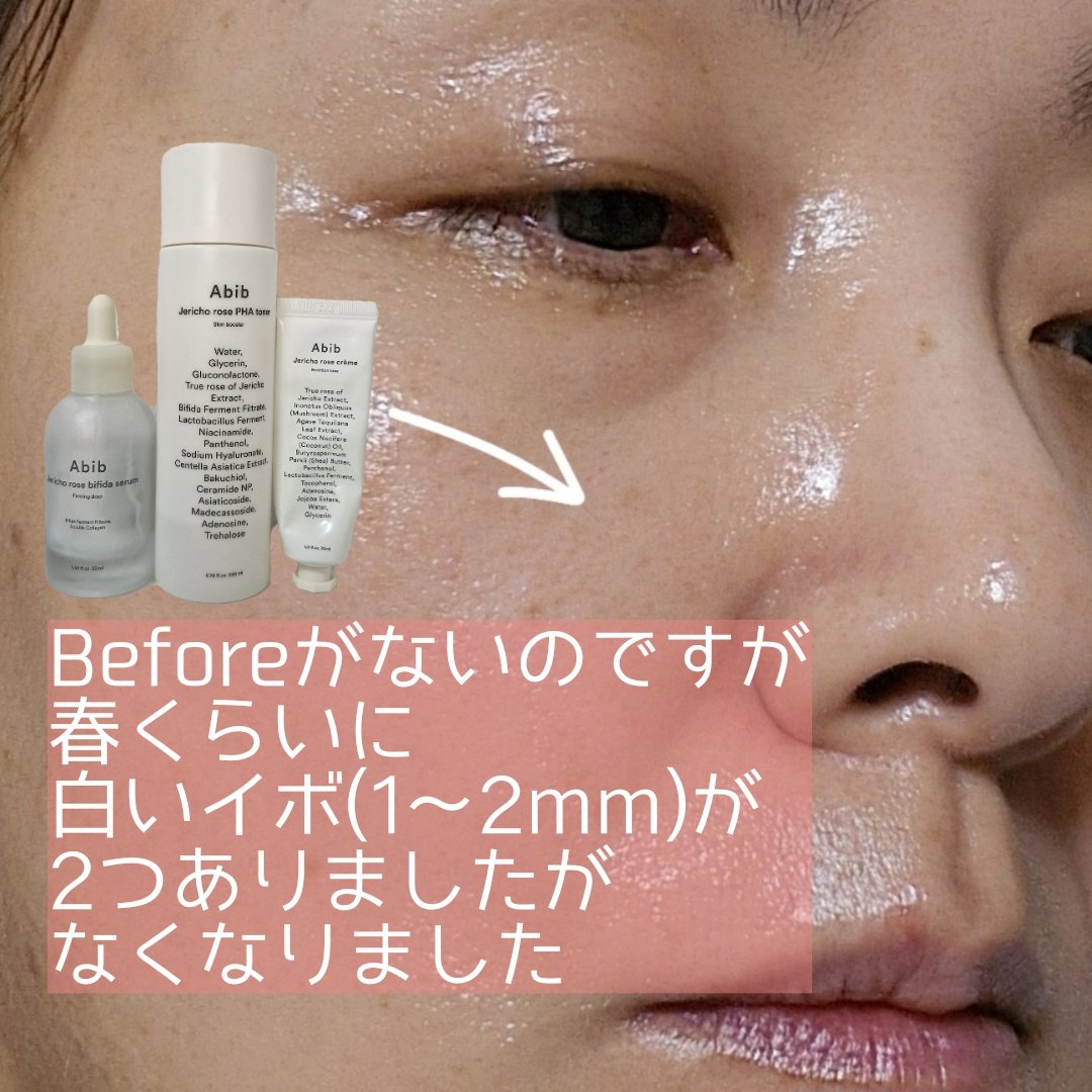 復活草PHAトナー スキンブースター/Abib /化粧水を使ったクチコミ（1枚目）