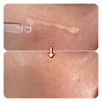 コアタイムアンプル/NEURADERM/美容液を使ったクチコミ(5枚目)