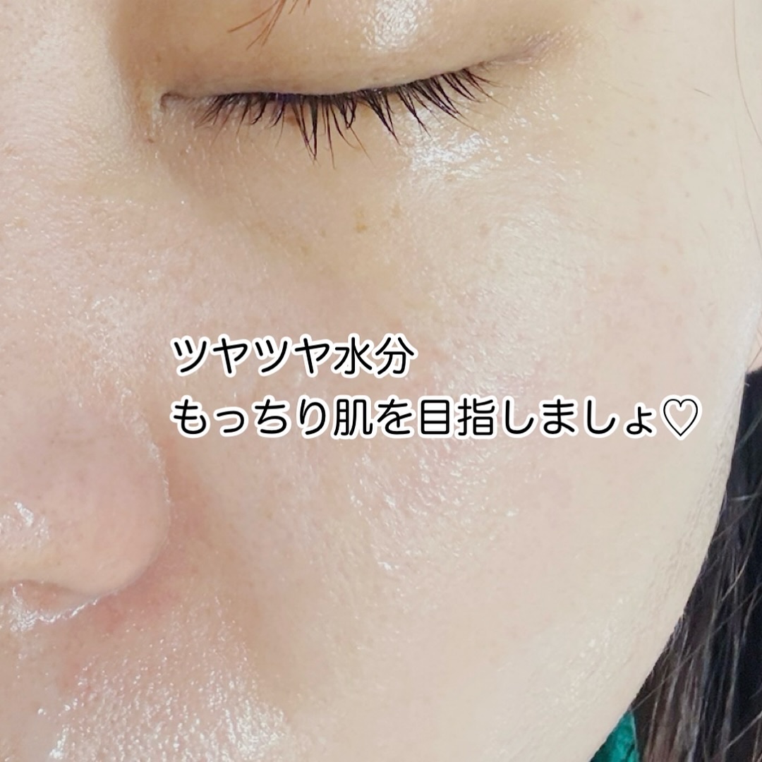 マデカソサイドエッセンシャルマスク/MEDIHEAL/シートマスク・パックを使ったクチコミ（3枚目）