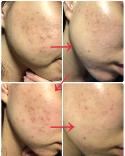 化粧水・敏感肌用・高保湿タイプ/無印良品/化粧水を使ったクチコミ(3枚目)