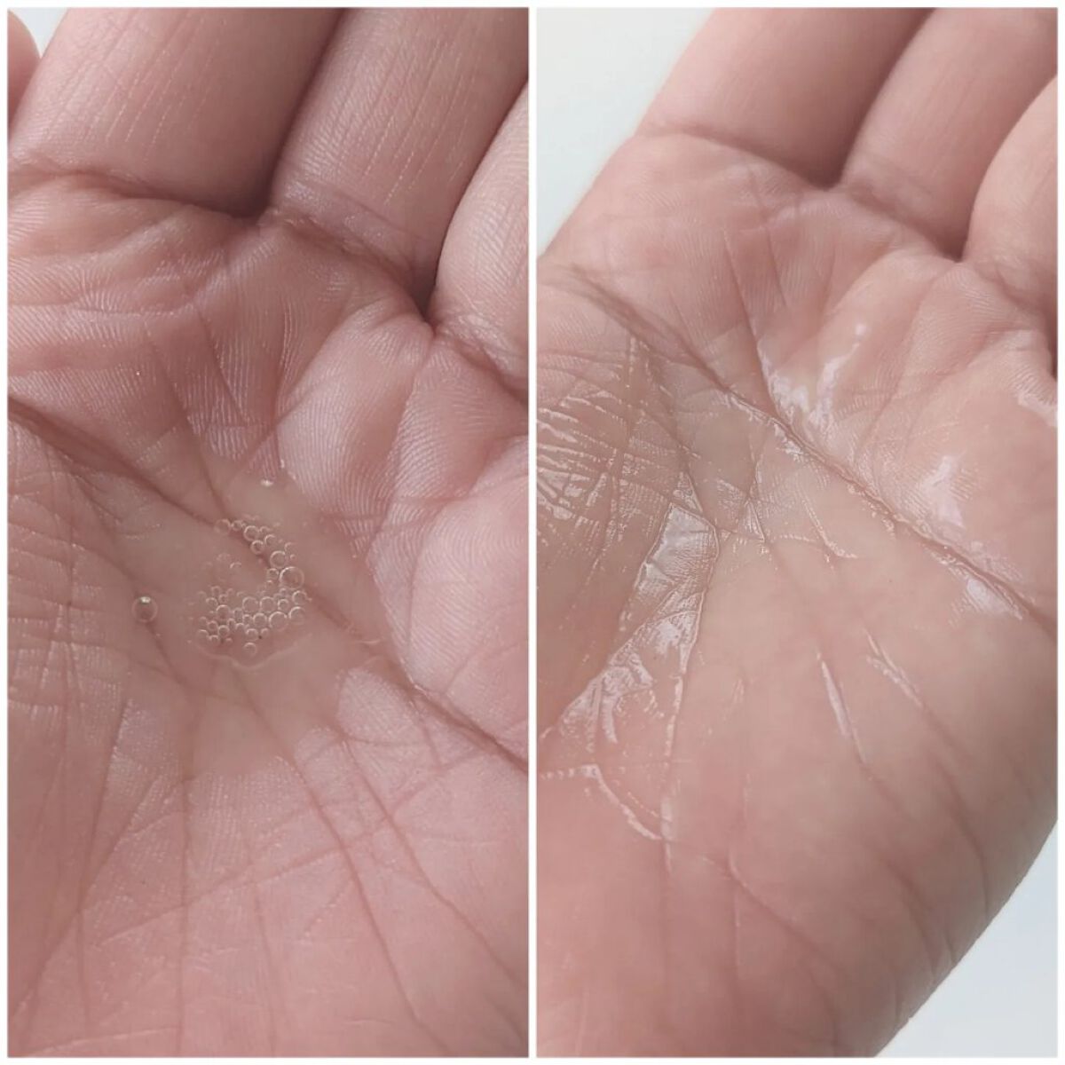 ゴールデンVC ブライト カプセルドリップ/fracora/化粧水を使ったクチコミ（3枚目）