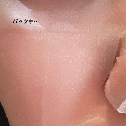 ダーマレーザー スーパー VC100 ホワイトマスク/クオリティファースト/シートマスク・パックを使ったクチコミ(4枚目)