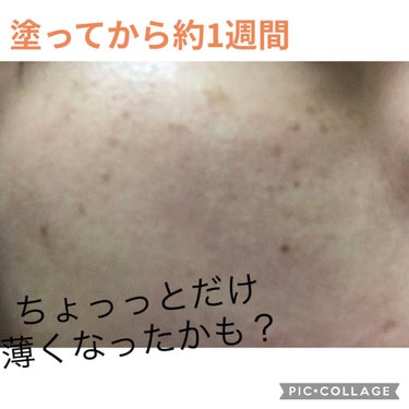 薬用 しみ 集中対策 美容液/メラノCC/美容液を使ったクチコミ（3枚目）