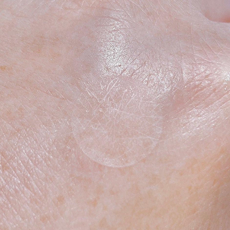 極薄透明パッチ nikipa!/金冠堂/にきびパッチを使ったクチコミ(3枚目)